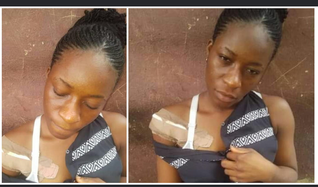 Photos of 200L Student Shot By Armed Robbers In Rivers For Resisting Rape Attempt